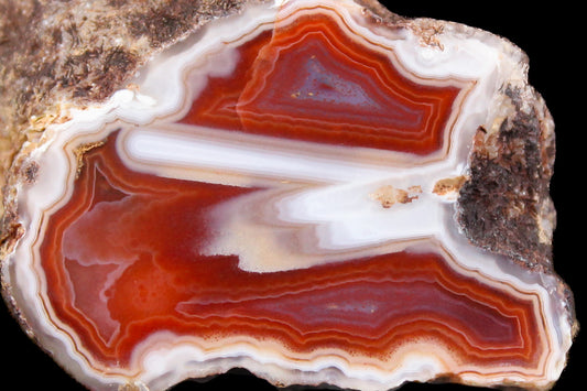 Malawi