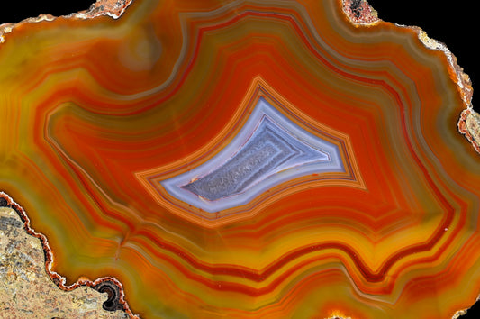 Argentinien