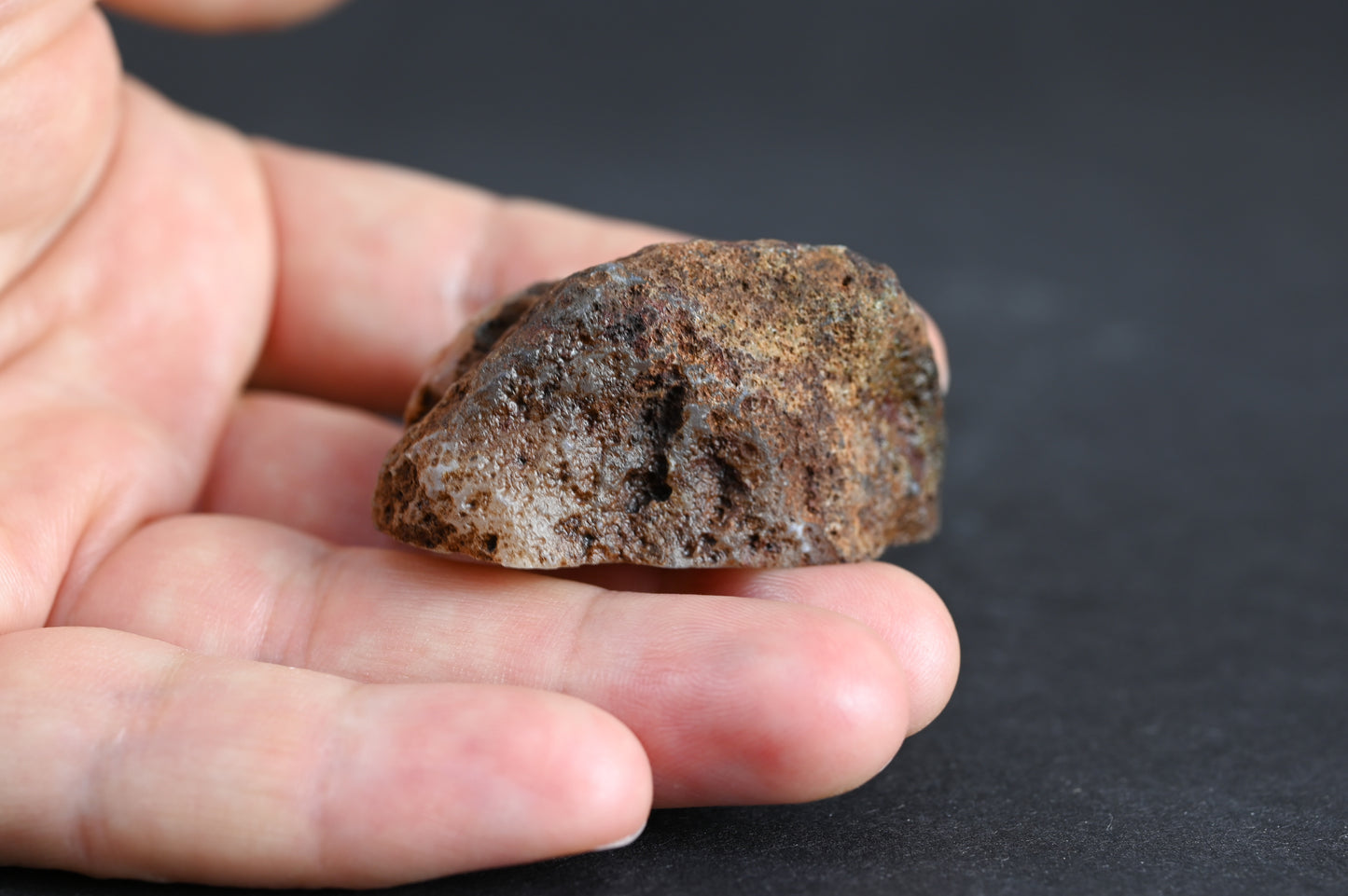 Malawi