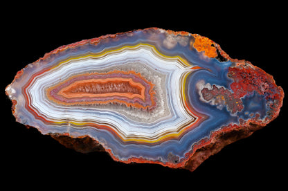 Malawi