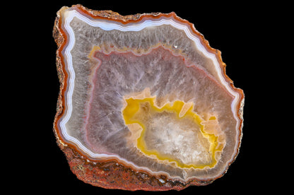 Malawi