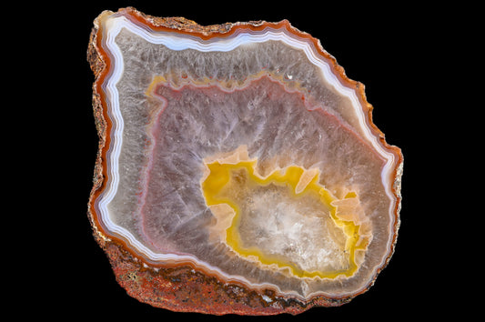 Malawi