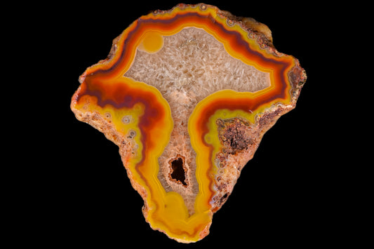 Malawi