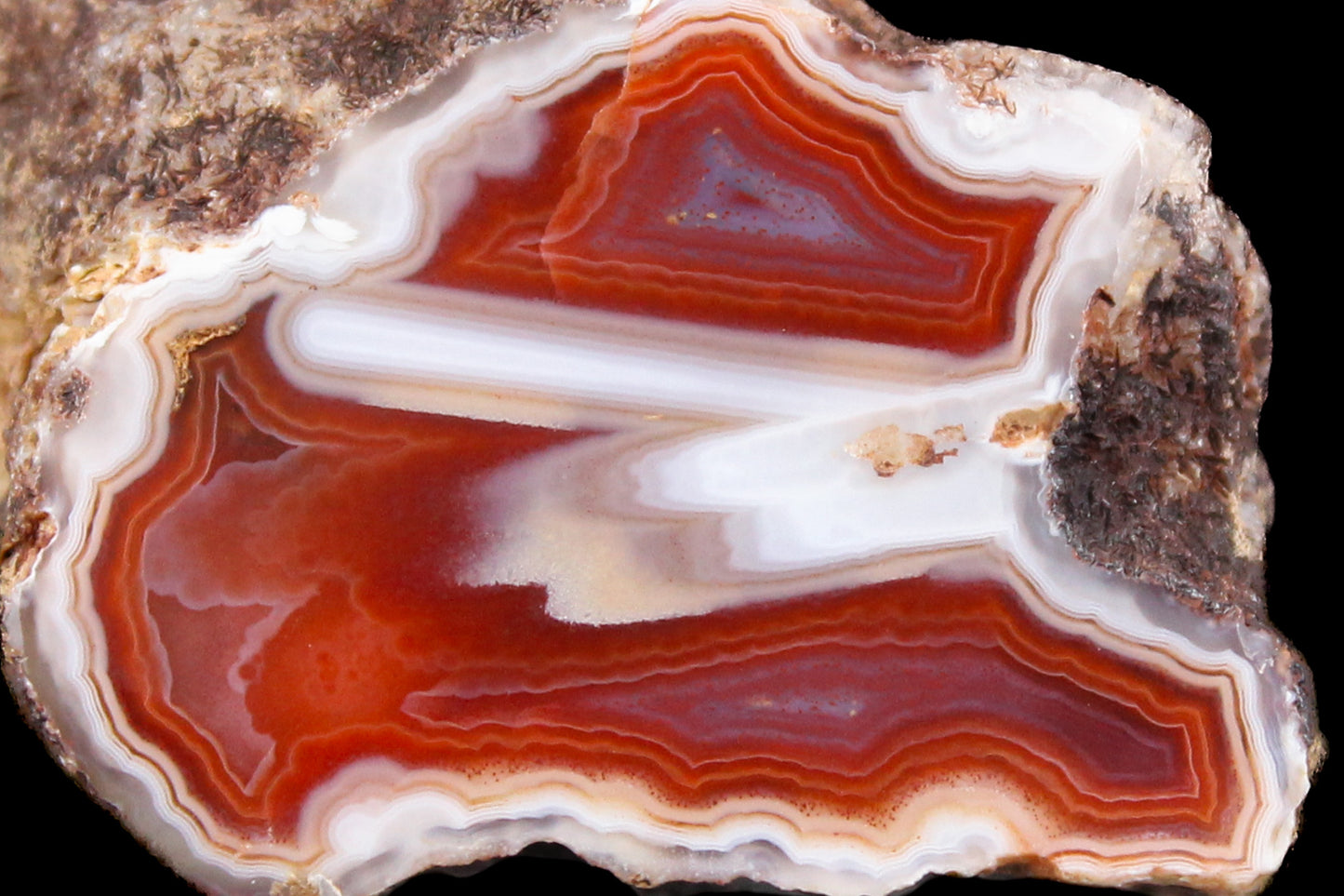 Malawi